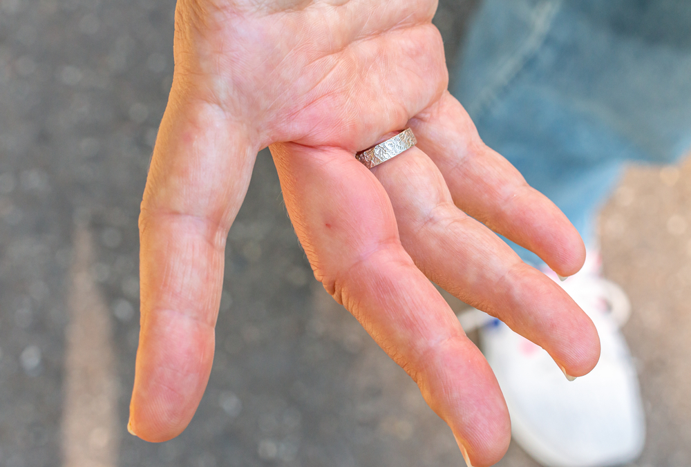Why Silicone Rings Are a Great Alternative If You Have a Metal Allergy